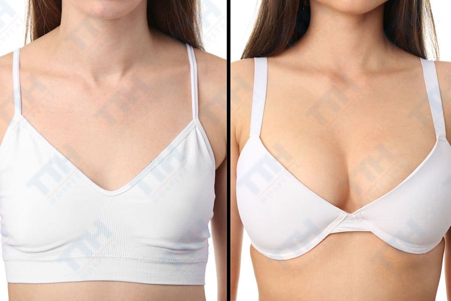 kết quả sau phẫu thuật nâng ngực