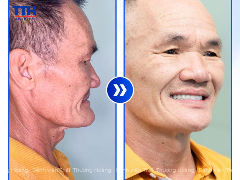 khách hàng sẽ được đội ngũ bác sĩ chuyên khoa giàu kinh nghiệm trực tiếp thăm khám
