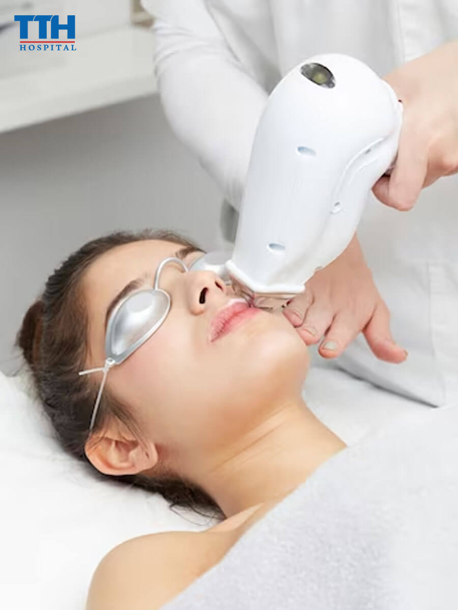 Laser CO2 Fractional là gì?