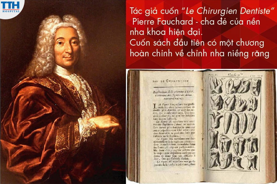 Sự Ra Đời Của Niềng Răng Mắc Cài Kim Loại