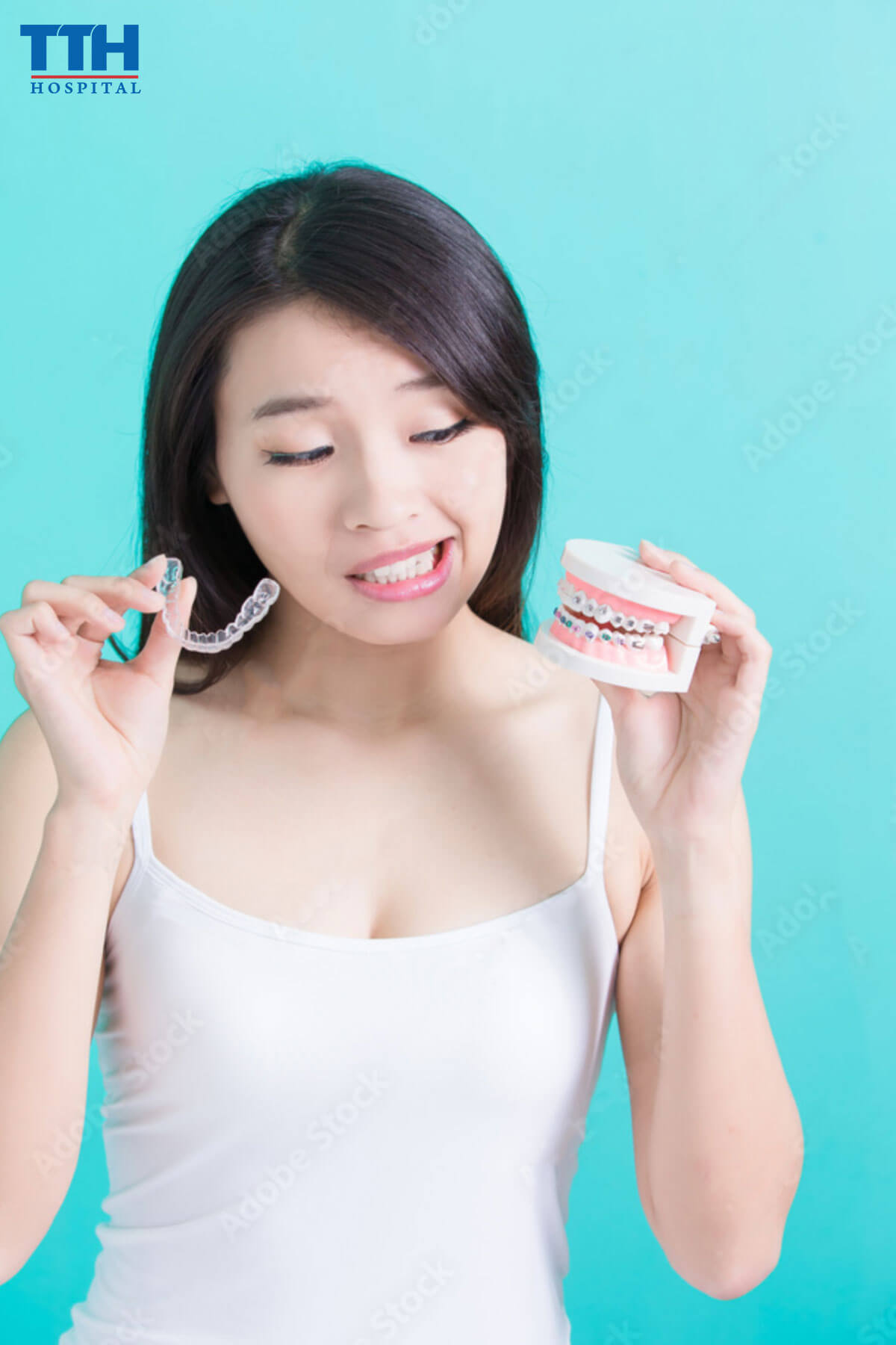 Loại niềng răng trong suốt nào tốt cho trẻ em:
