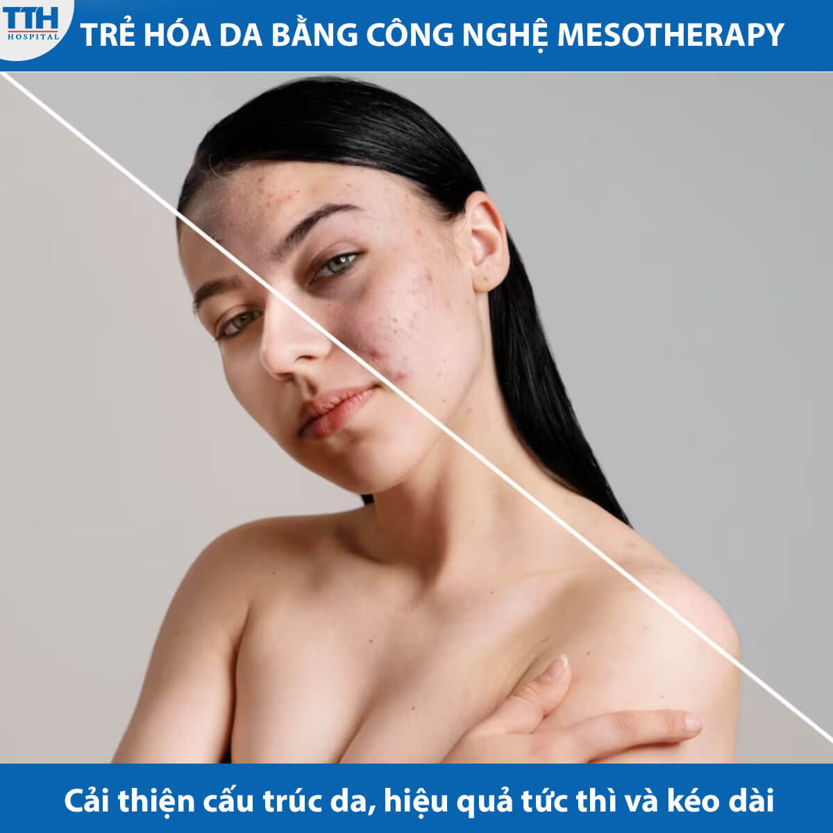 Lợi ích của Mesotherapy