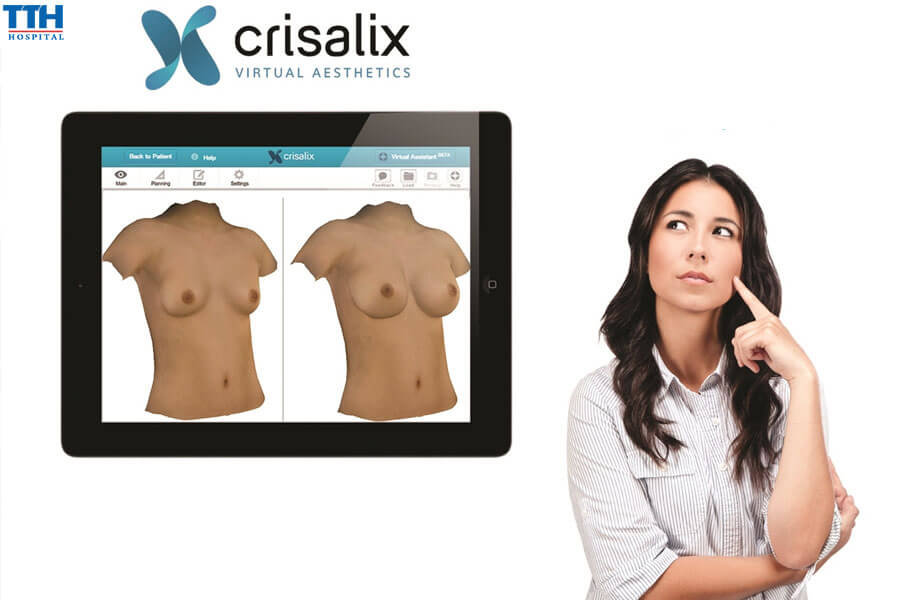 Crisalix 3D Là Gì?