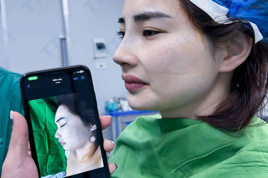 Những lưu ý khi bạn quyết định hồi hương làm đẹp ngày Tết