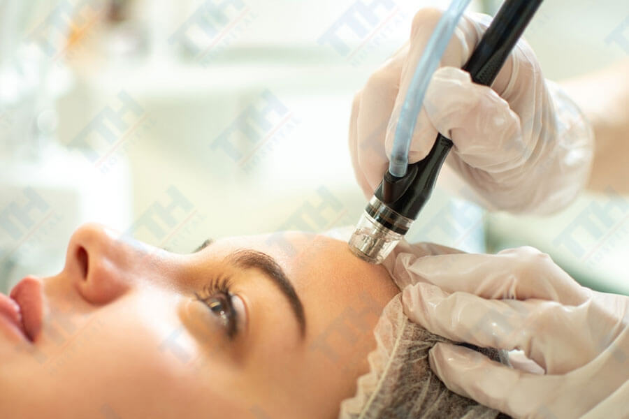 Microdermabrasion