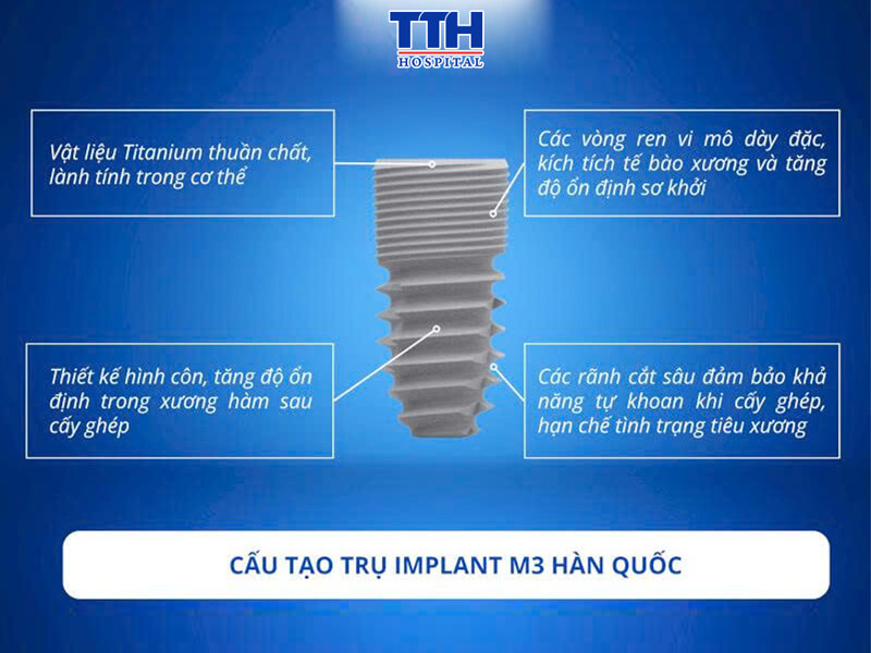 MỘT SỐ ĐIỂM NỔI TRỘI TRONG THIẾT KẾ CỦA IMPLANT M3