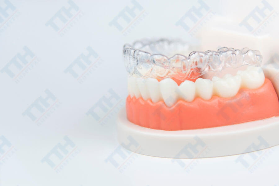 Một trong những ưu điểm rõ rệt nhất của TTH Aligners so với niềng răng truyền thống là tính thẩm mỹ.