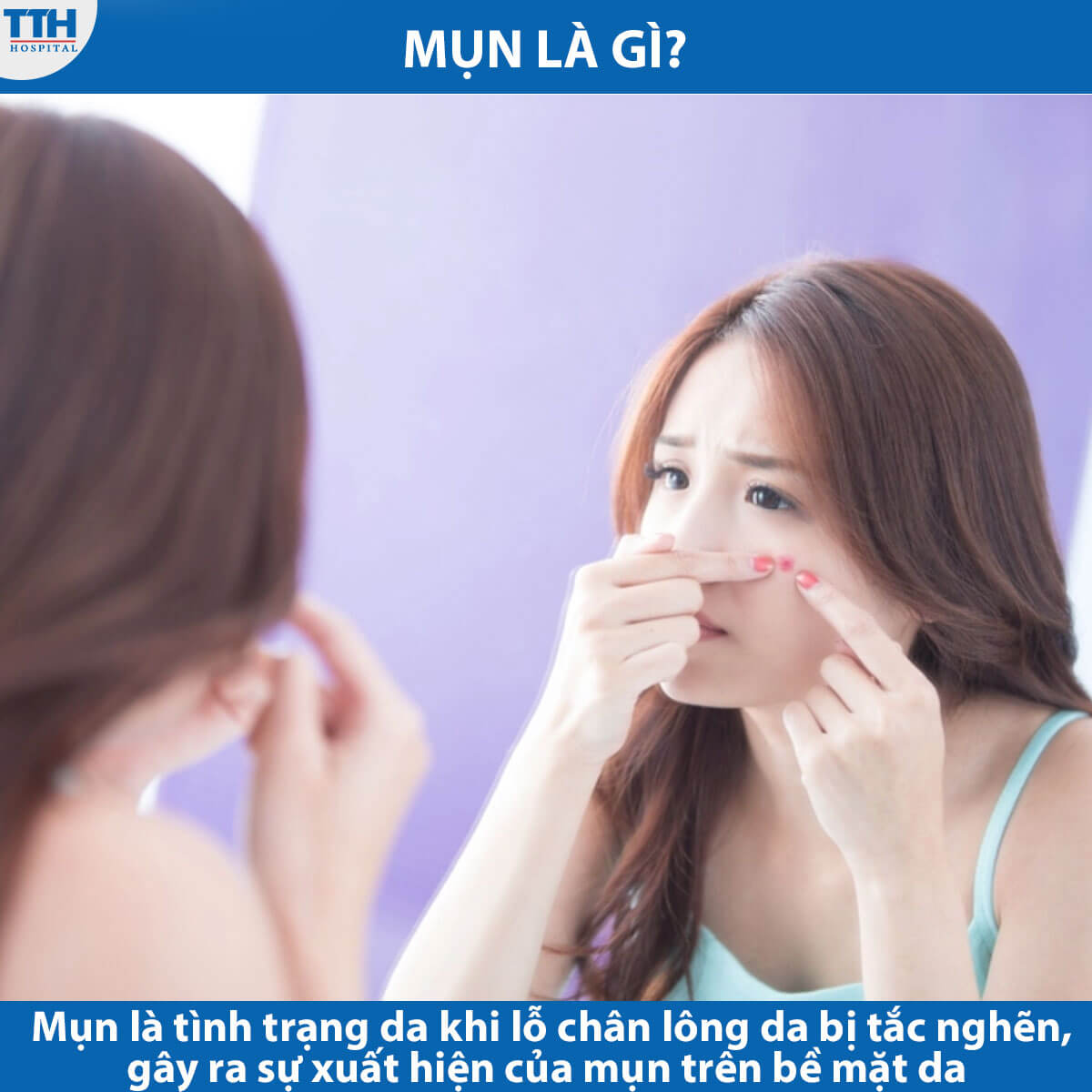 Mụn là gì