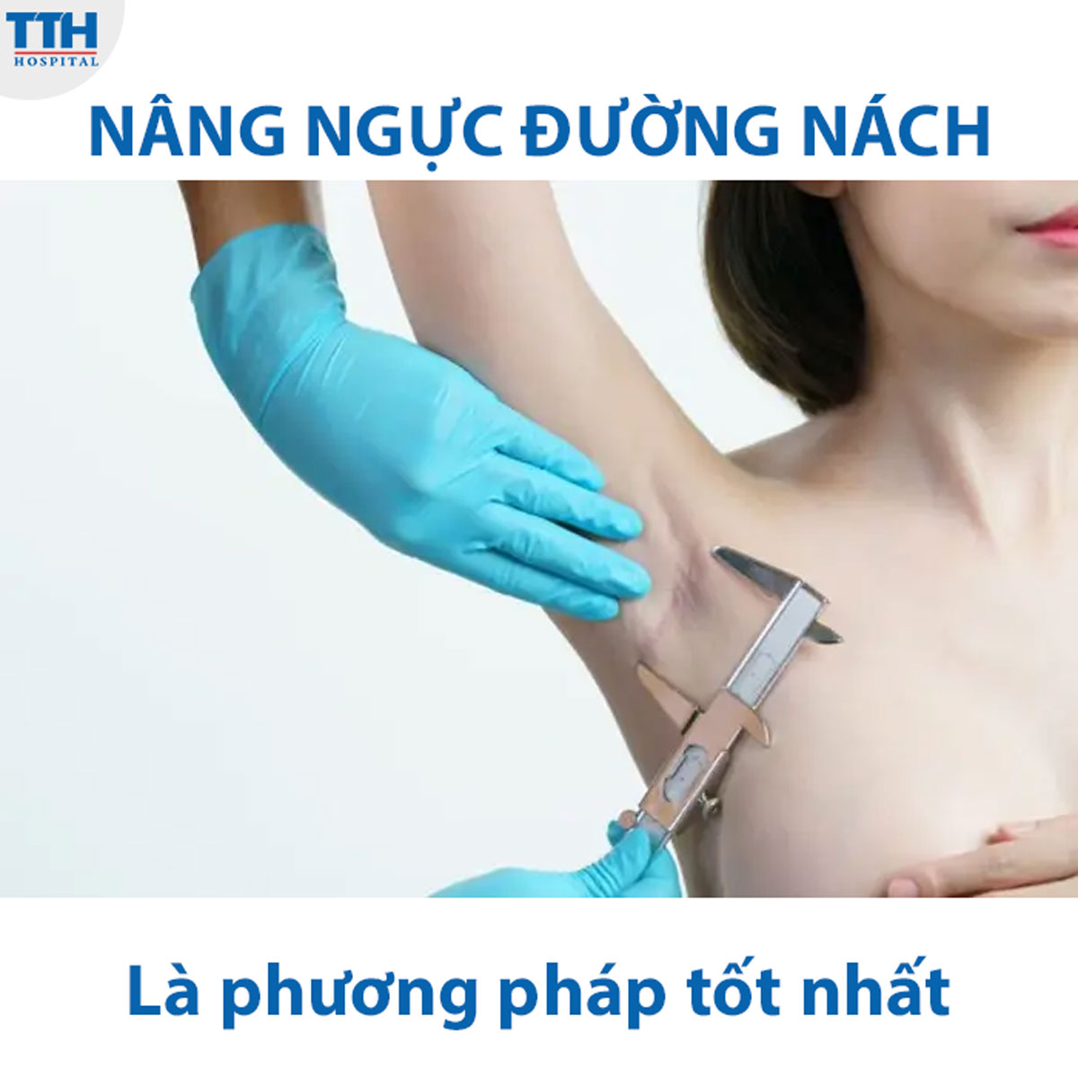 Nâng ngực đường nách là phương pháp được đánh giá là tốt nhất hiện nay