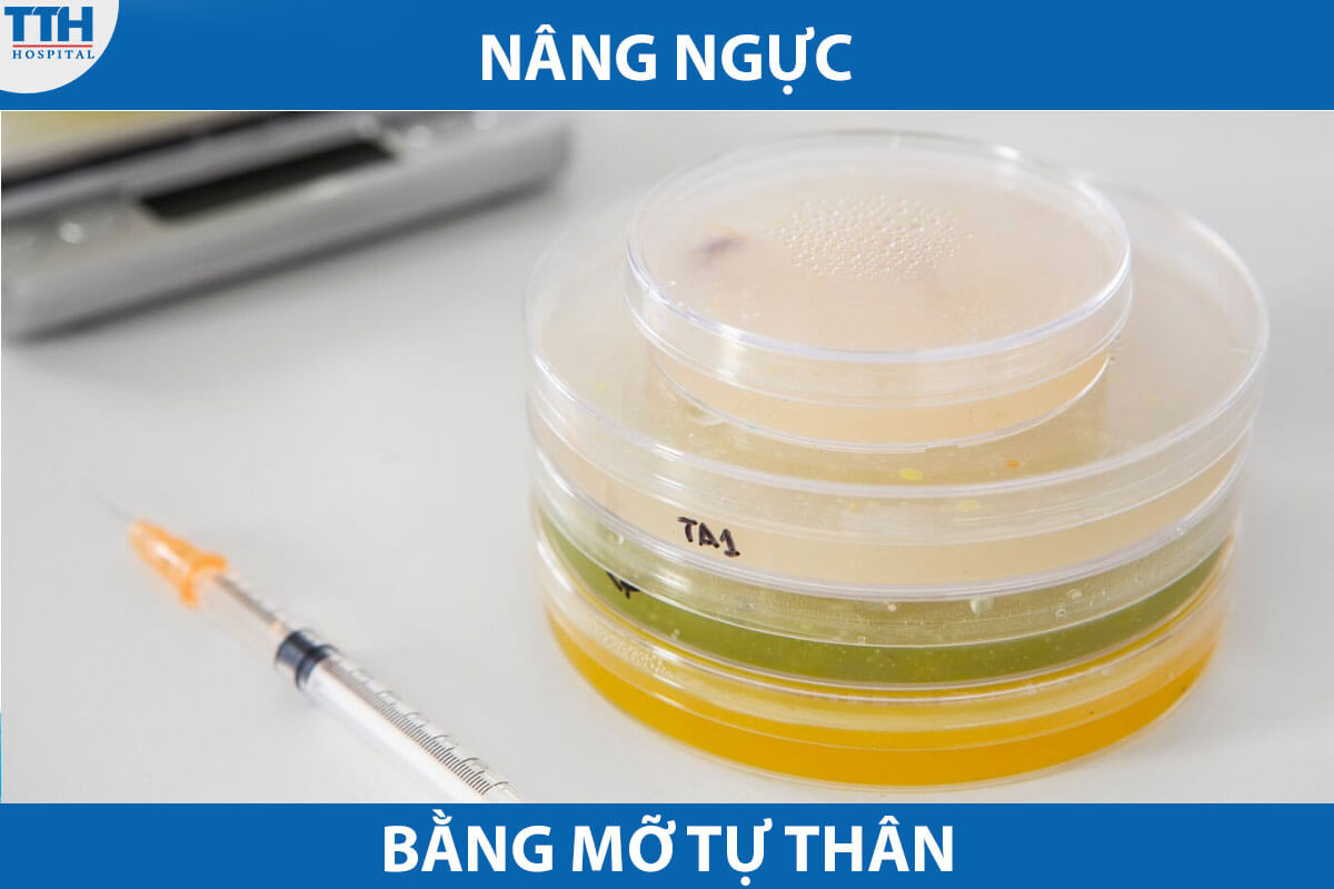 Nâng ngực bằng mỡ tự thân