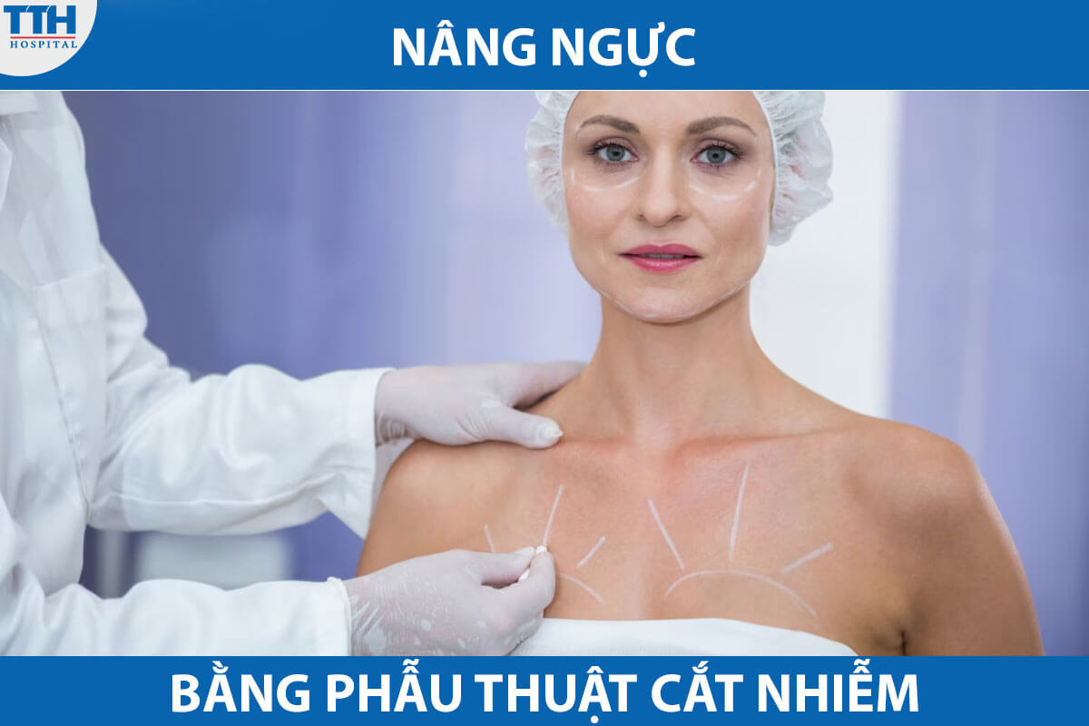 Nâng ngực bằng phẫu thuật cắt nhiễm