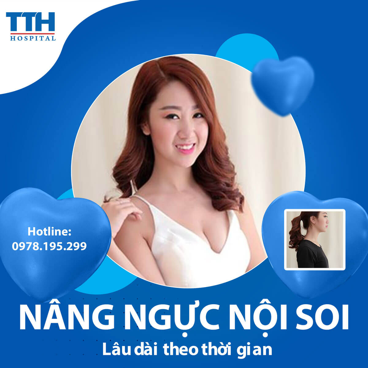 Nâng Ngực Bằng Phương Pháp Nội Soi