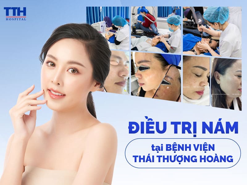 Điều Trị Nám Da An Toàn – Hiệu Quả Tại Bệnh Viện Thái Thượng Hoàng