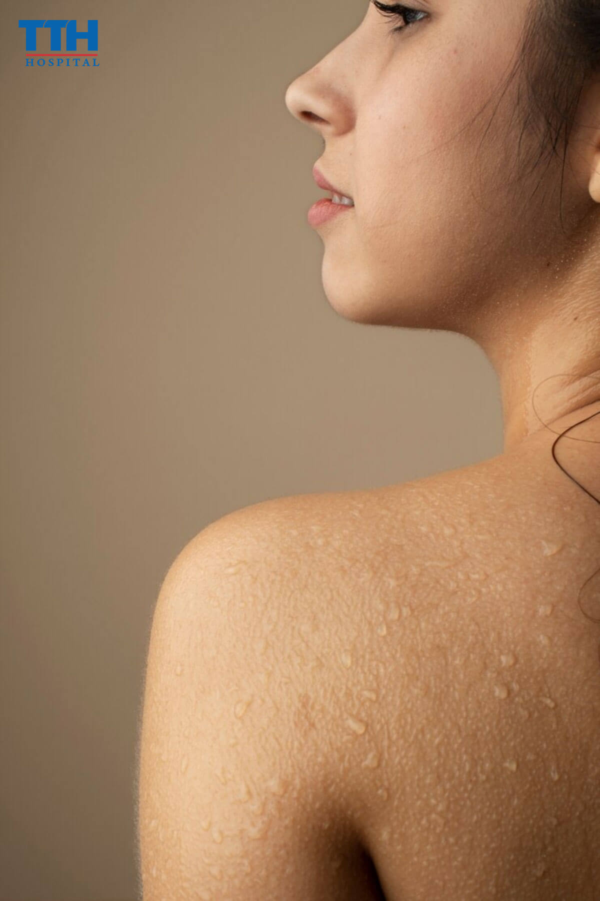 Nguyên nhân gây ra da thiếu nước
