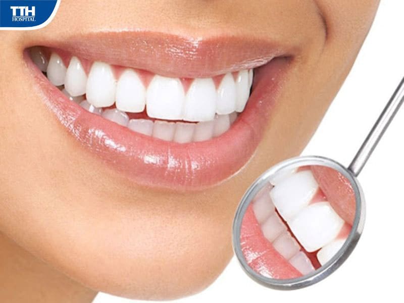 Nguyên nhân khiến răng bị thưa