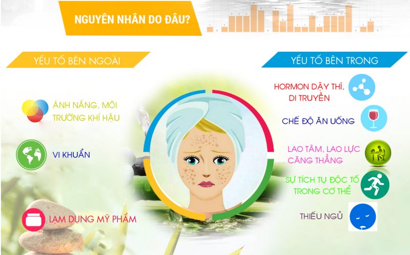 Các loại mụn và nguyên nhân gây mụn