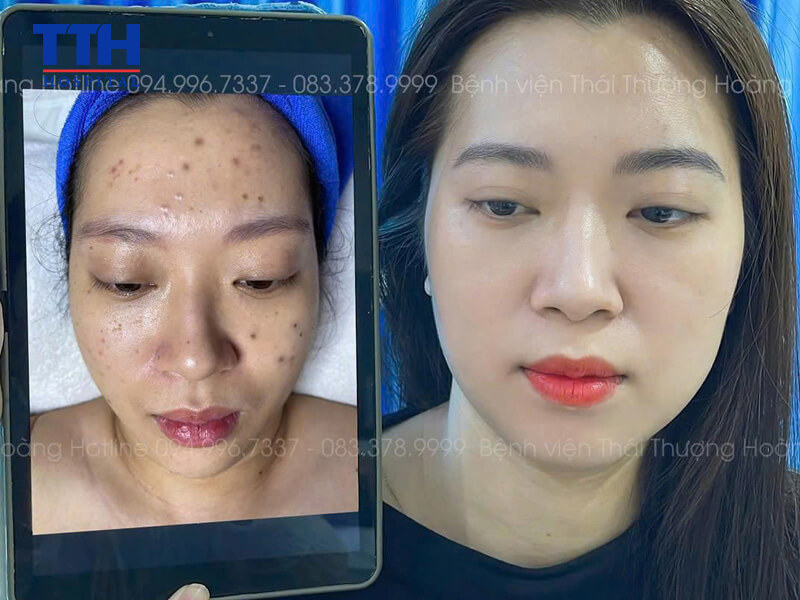 Nhanh tay đăng ký – đẹp chuẩn chỉnh, giá siêu xinh!