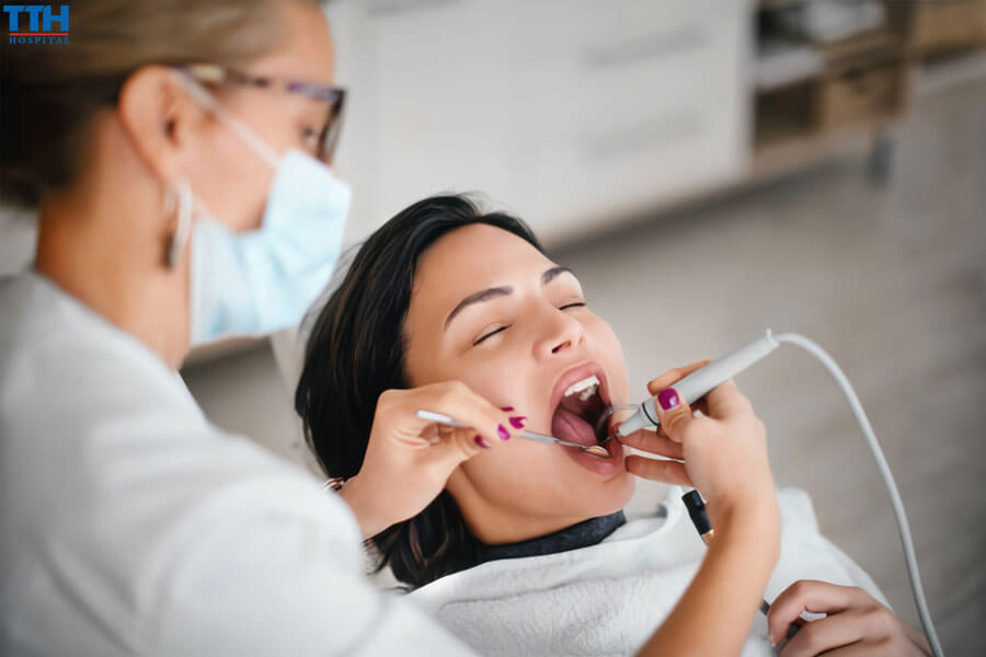 Những Điều Cần Biết Khi Lấy Cao Răng Tại Vinh