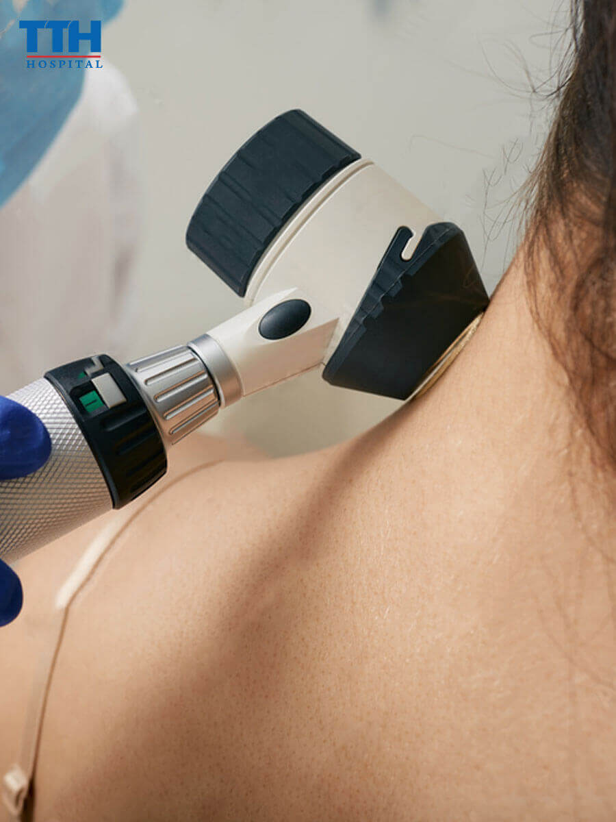 Những Điều Cần Biết Trước Khi Quyết Định Xóa Vết Bớt Tại Vinh