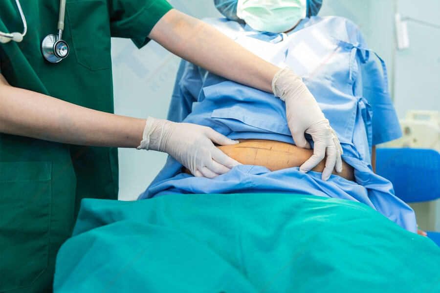Những lưu ý khi thực hiện phẫu thuật thẩm mỹ