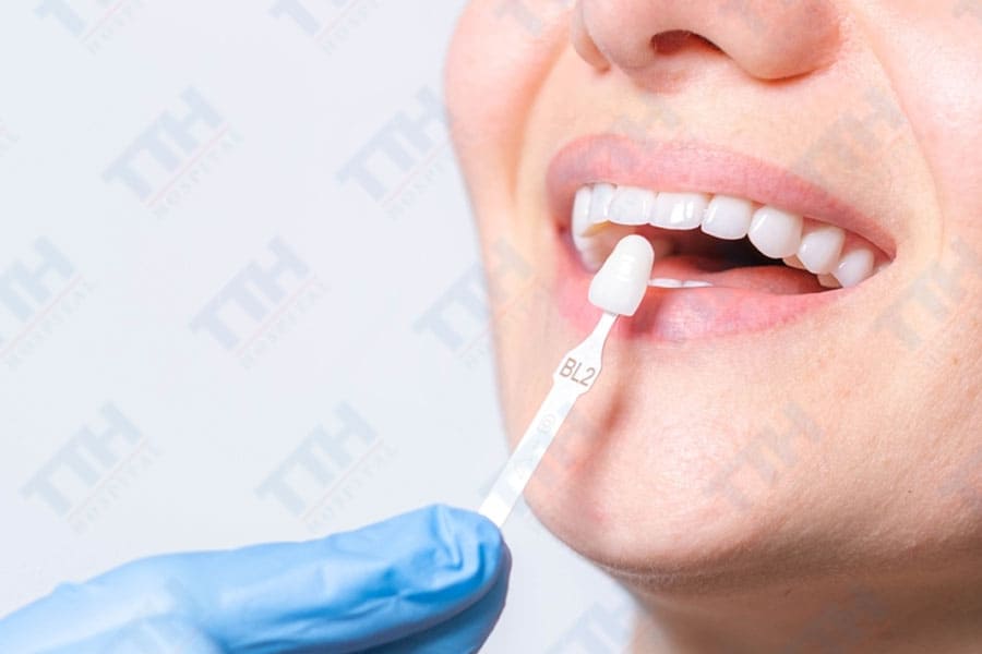Những Phương Pháp Thẩm Mỹ Răng Sứ Phổ Biến