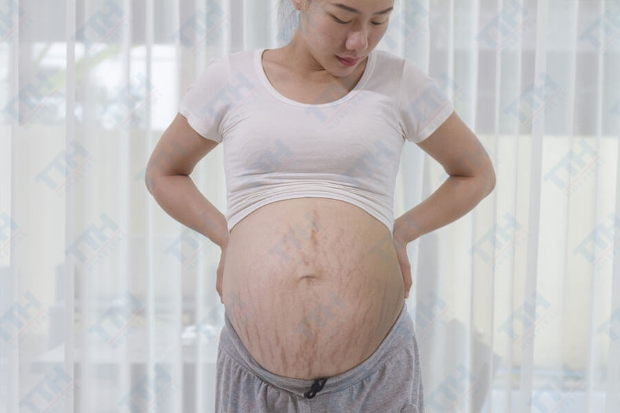 Những thay đổi tiêu cực của làn da trong thai kỳ