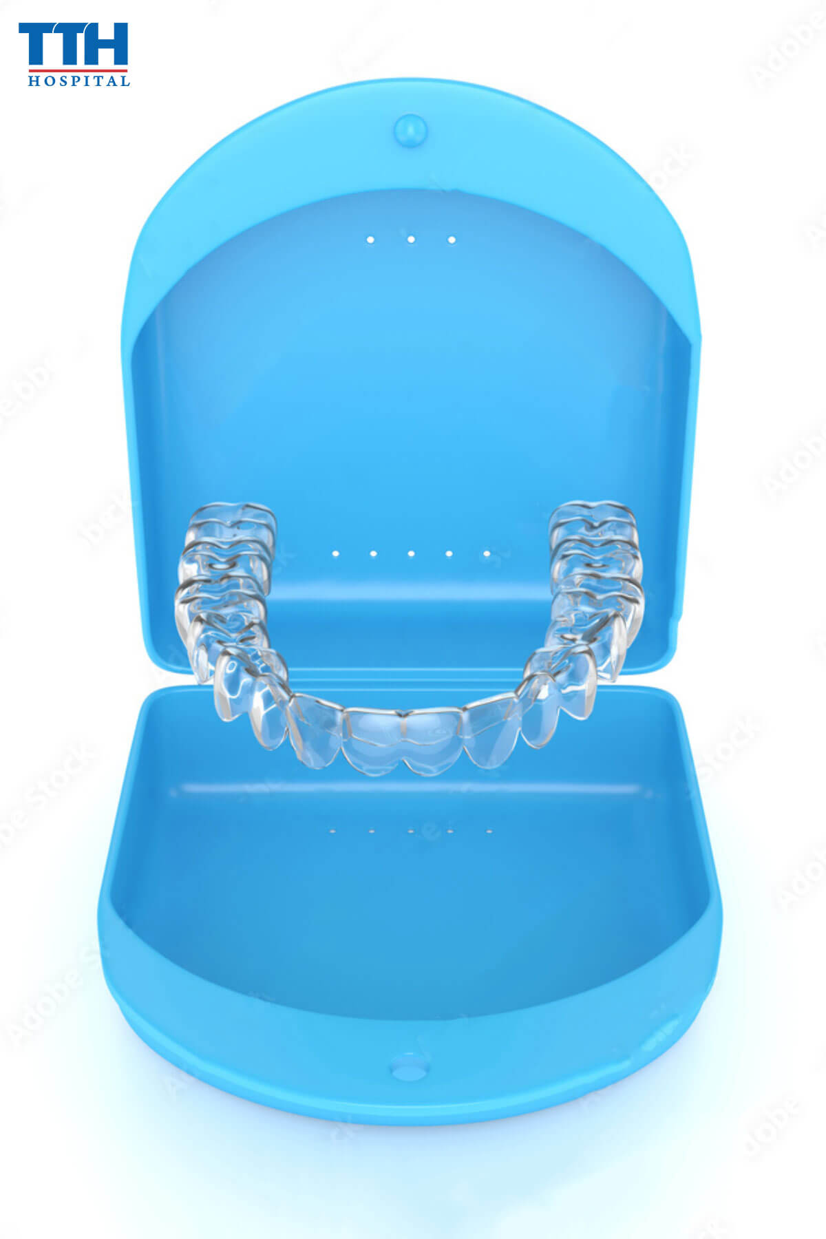 Nhược điểm của niềng răng trong suốt