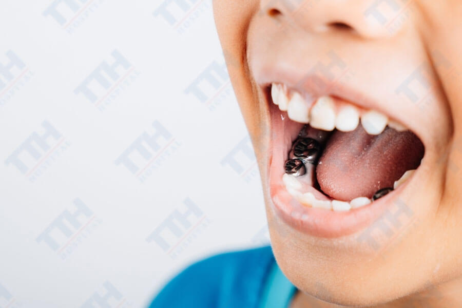 Nhược điểm và những điều cần cân nhắc