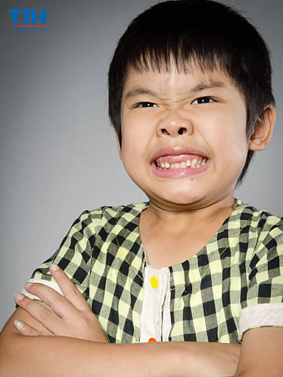 Niềng răng của trẻ em cần chọn Đúng Thời Điểm