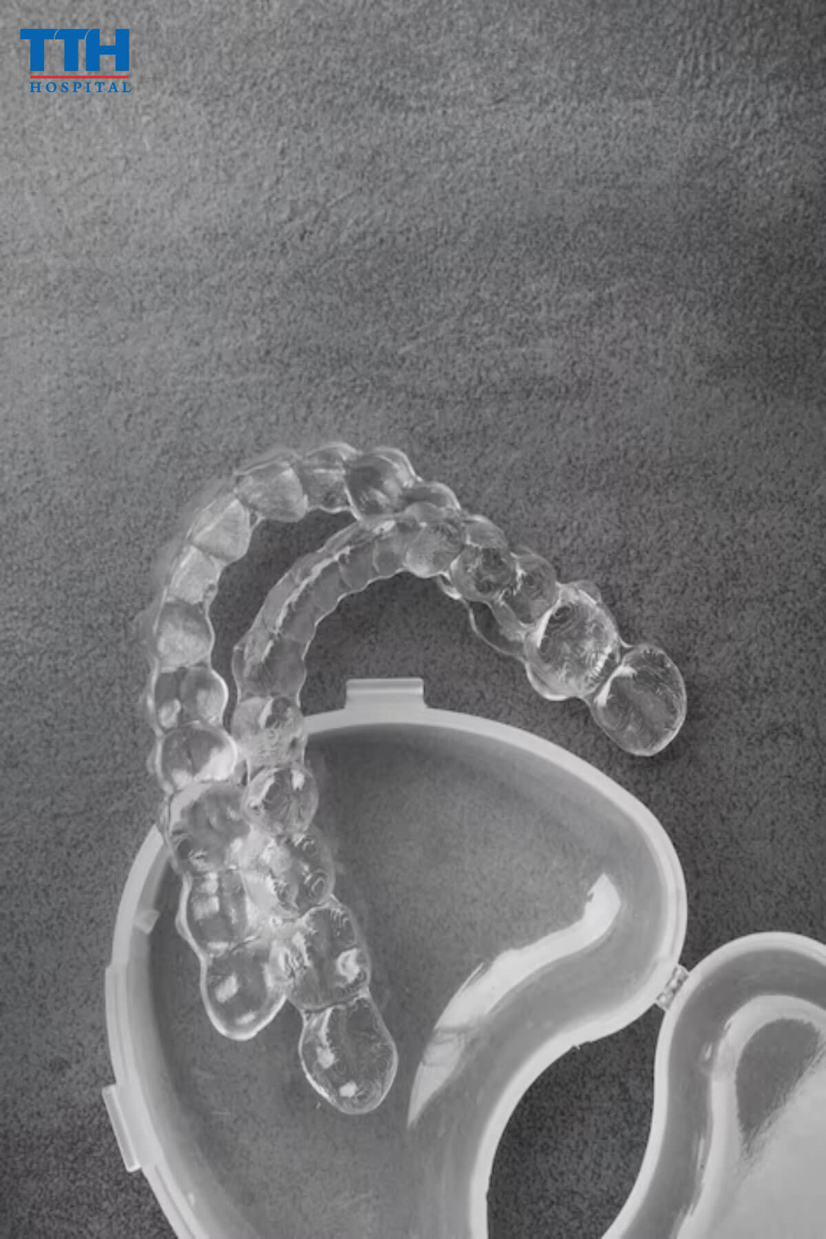 Niềng răng Invisalign là gì?