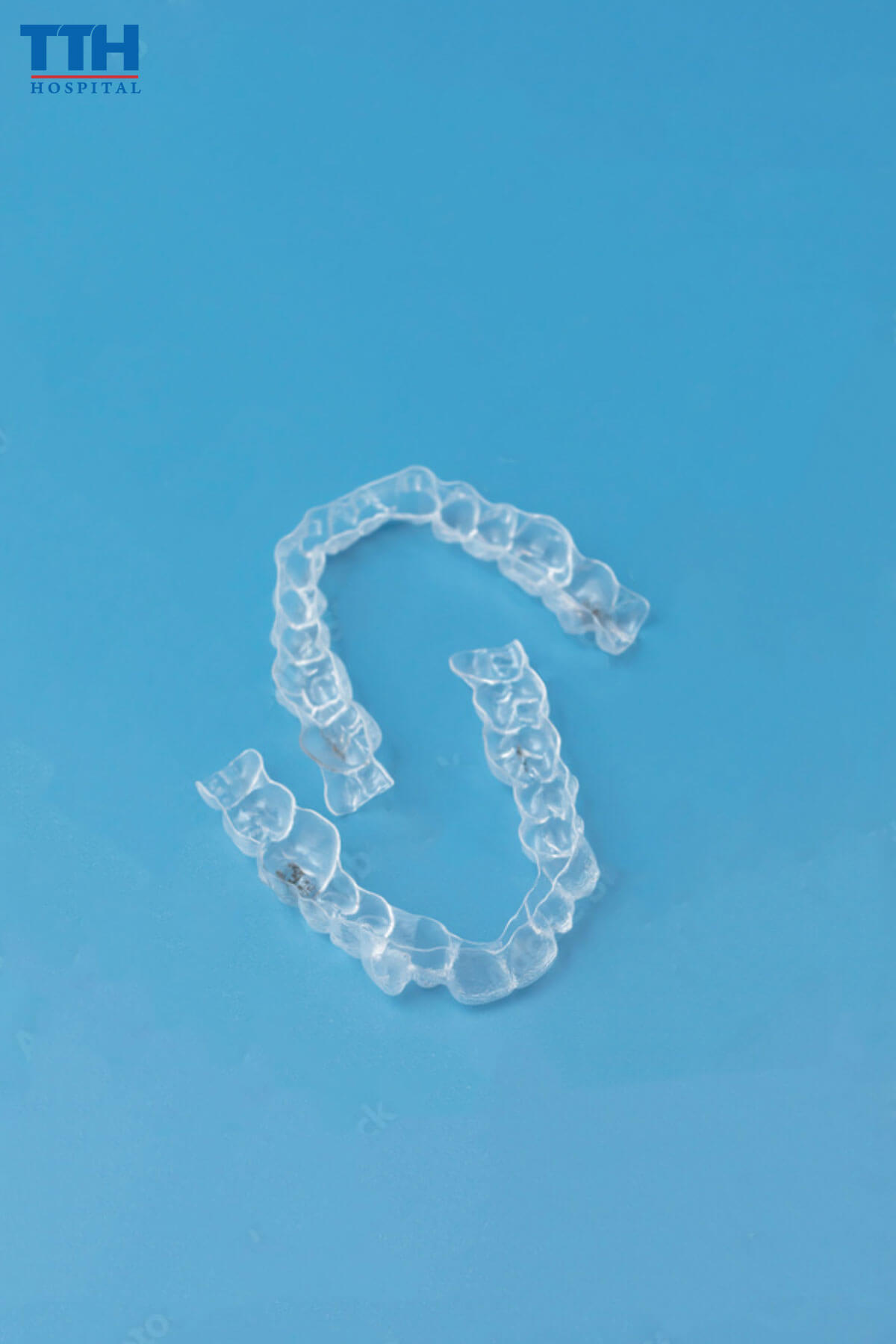 Niềng răng trong suốt Clear Aligner tại vinh nghệ an