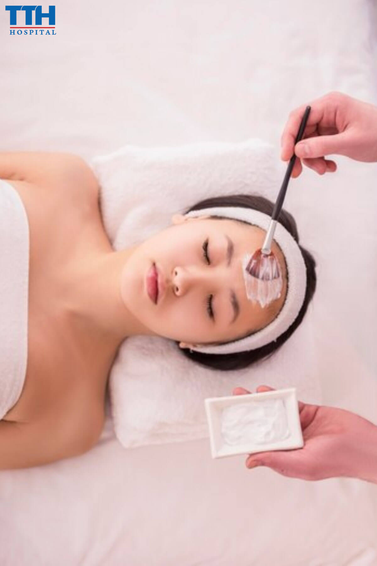 Trị nám da tại Vinh Nghệ An bằng Peeling hóa học