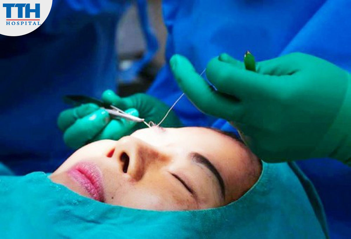 Cắt mí cũng có những rủi ro tiềm ẩn như nhiễm trùng, sưng,