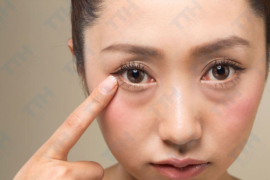 Phẫu thuật tạo hình mắt hai mí: Định nghĩa và mục đích