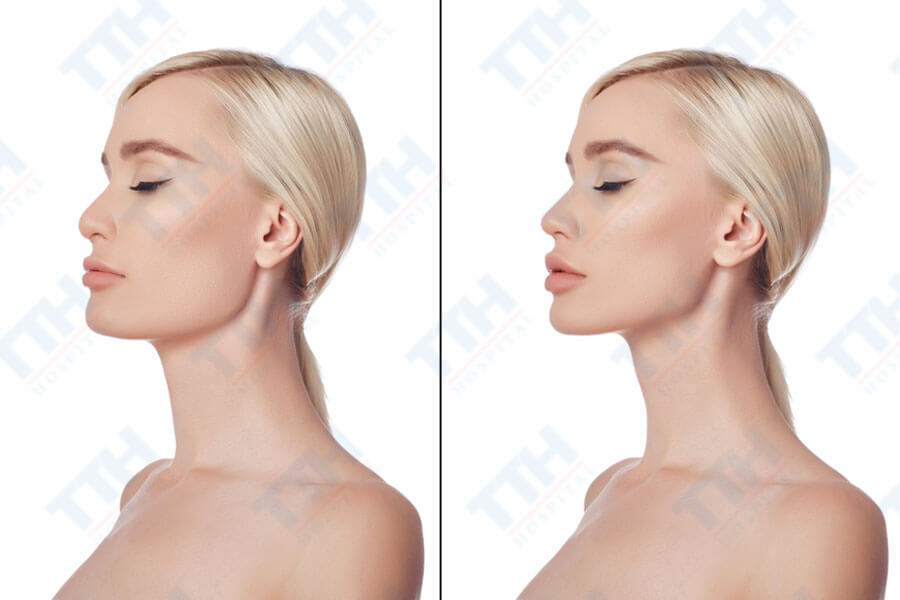 Phẫu thuật tạo hình môi và vòm miệng