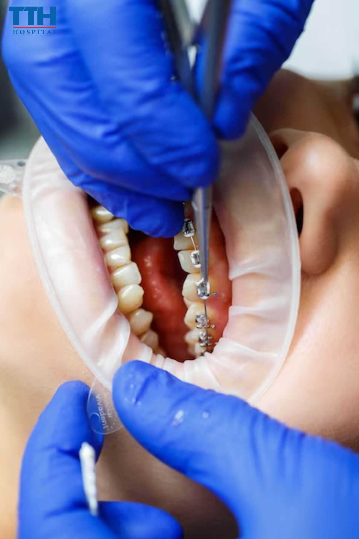 Phòng khám niềng răng uy tín tại Vinh, Nghệ An