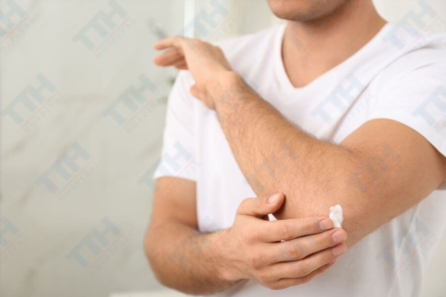 Phương pháp điều trị rạn da hiệu quả cho nam giới