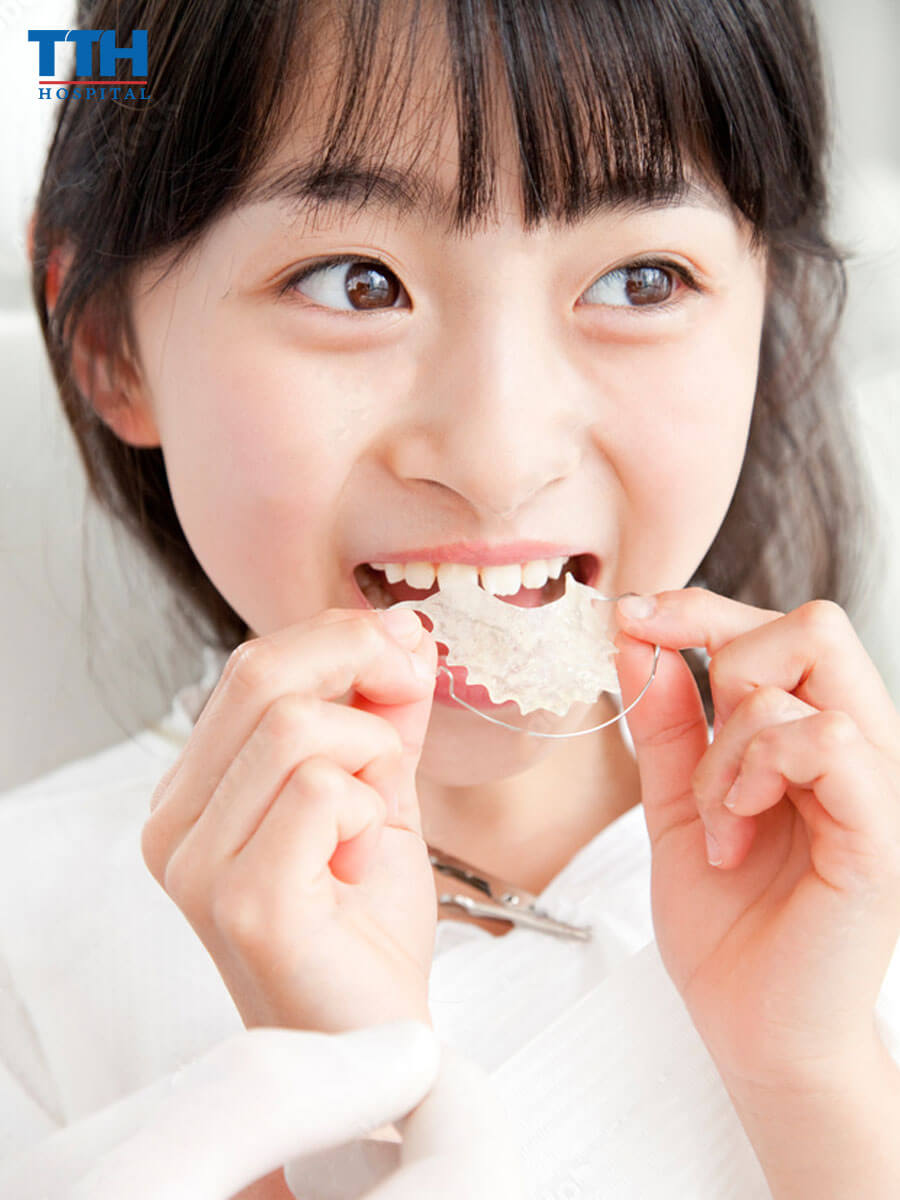 Phương Pháp Niềng Răng Cho Trẻ Dưới 10 Tuổi