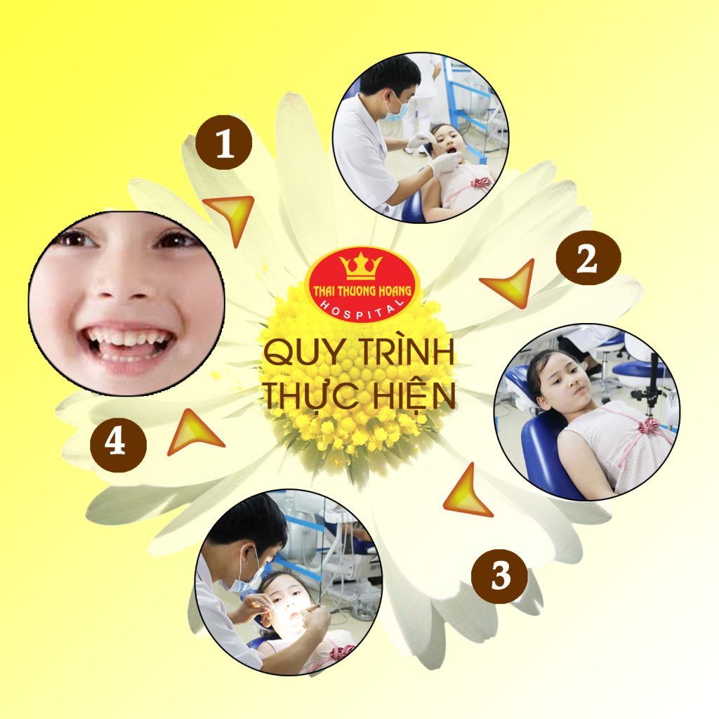 Tại Bệnh viện Thái Thượng Hoàng quy trình nhổ răng sữa