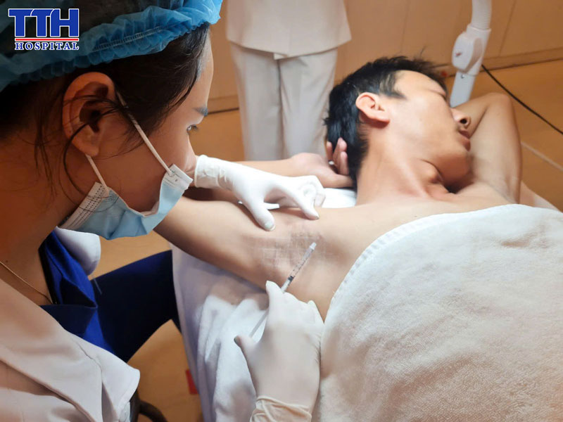 Quy trình điều trị khóa tuyến mồ hôi nách tại Bệnh viện Thái Thượng Hoàng