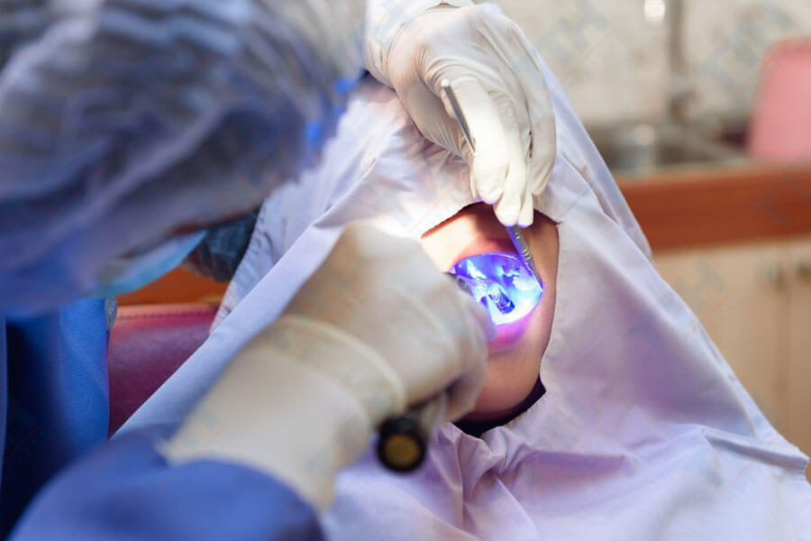 Quy trình điều trị tủy bằng laser