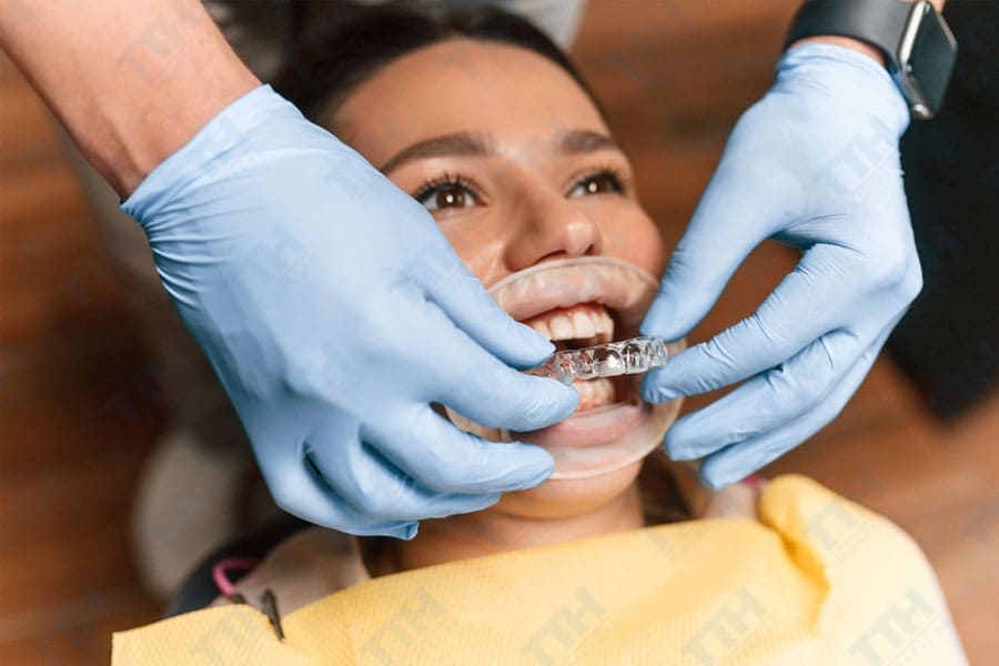 Quy Trình Niềng Răng Invisalign