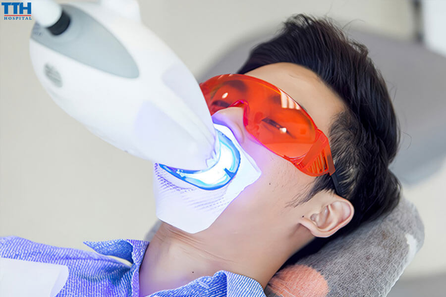 Quy Trình Tẩy Trắng Răng Bằng Công Nghệ Cold Light Lazer