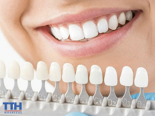 Bảng màu được cải tiến có sự đồng bộ với màu răng thật