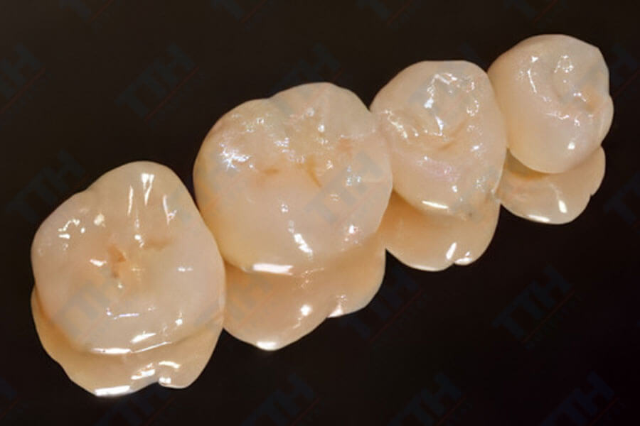 Răng sứ Lava DVS Digital Veneering System