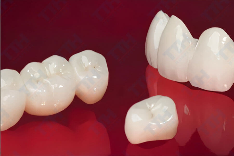 Răng Sứ Lava Premium