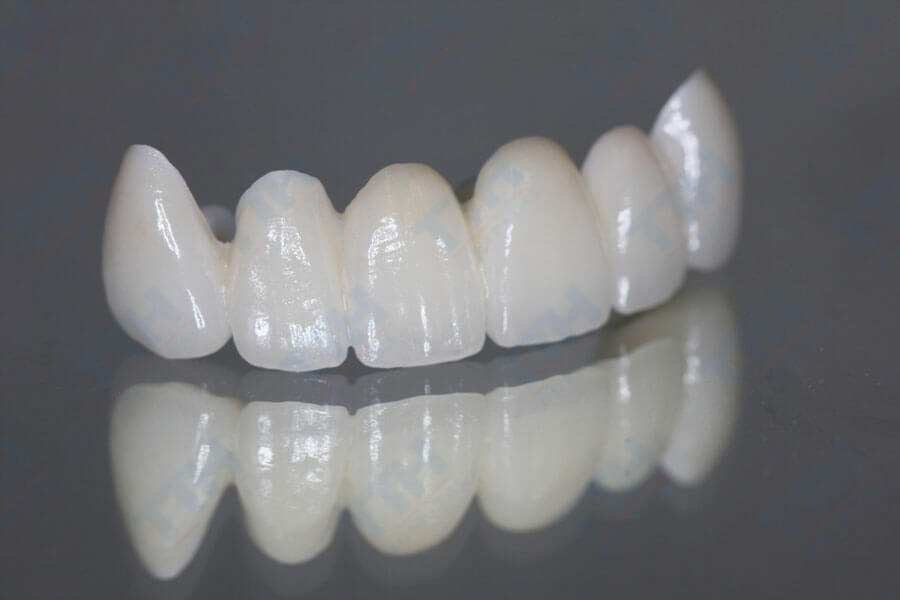 Răng Sứ Zirconia - Đẳng cấp của vẻ đẹp tự nhiên