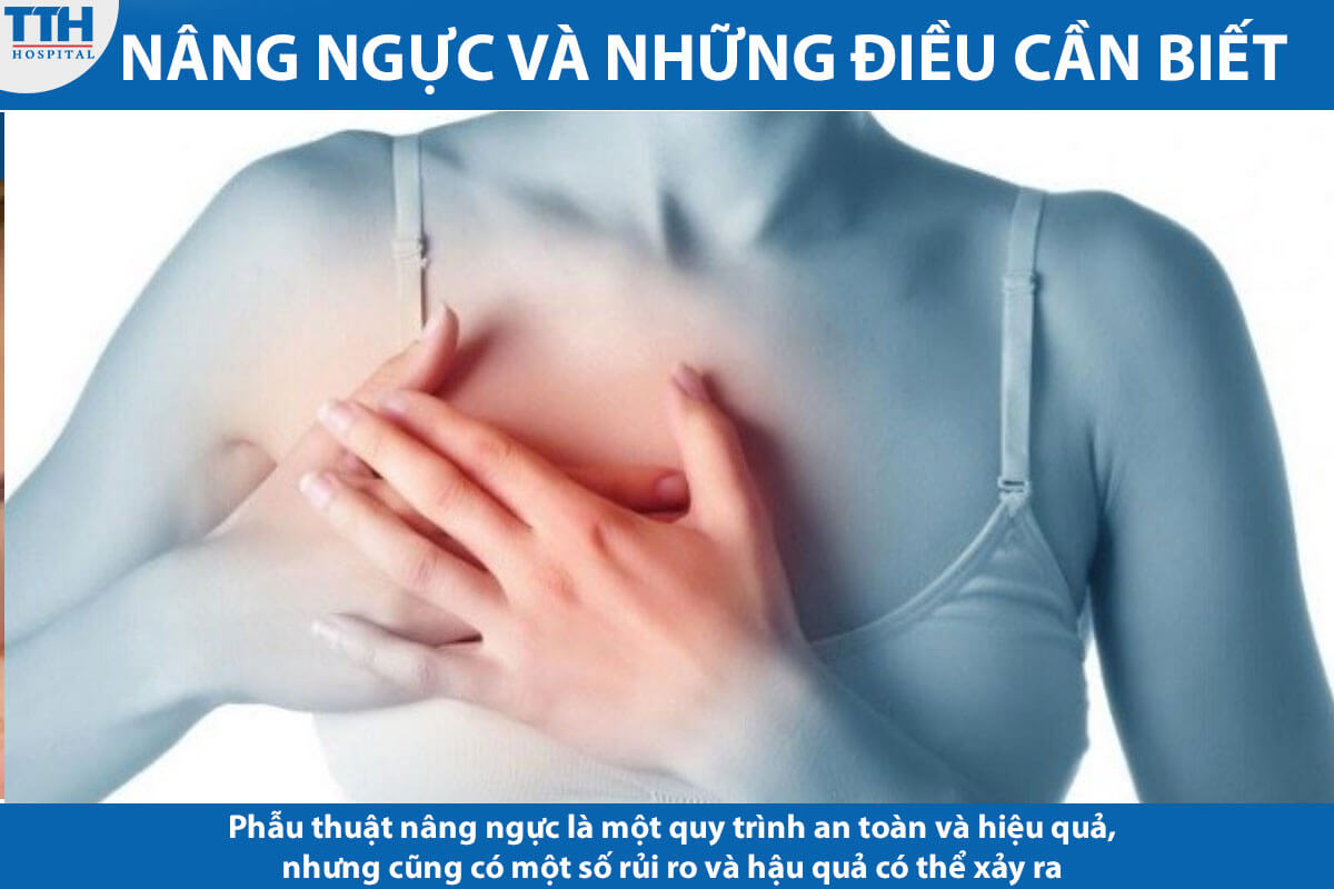 Phẫu thuật nâng ngực là một quy trình an toàn và hiệu quả, nhưng cũng có một số rủi ro và hậu quả có thể xảy ra