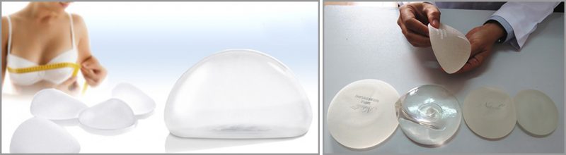 Nâng ngực nội soi bằng túi silicon là gì?