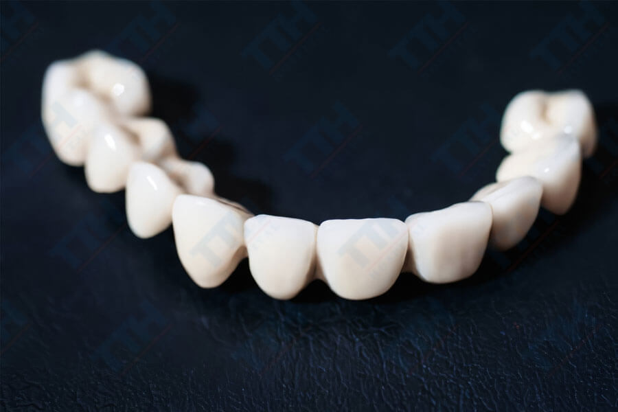 So sánh răng sứ Noritake với các loại răng sứ khác